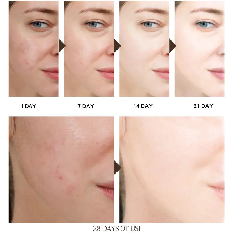 Collagen Face Cream Anti Wrinkle Anti Aging Dark Spot Remover - Assortique