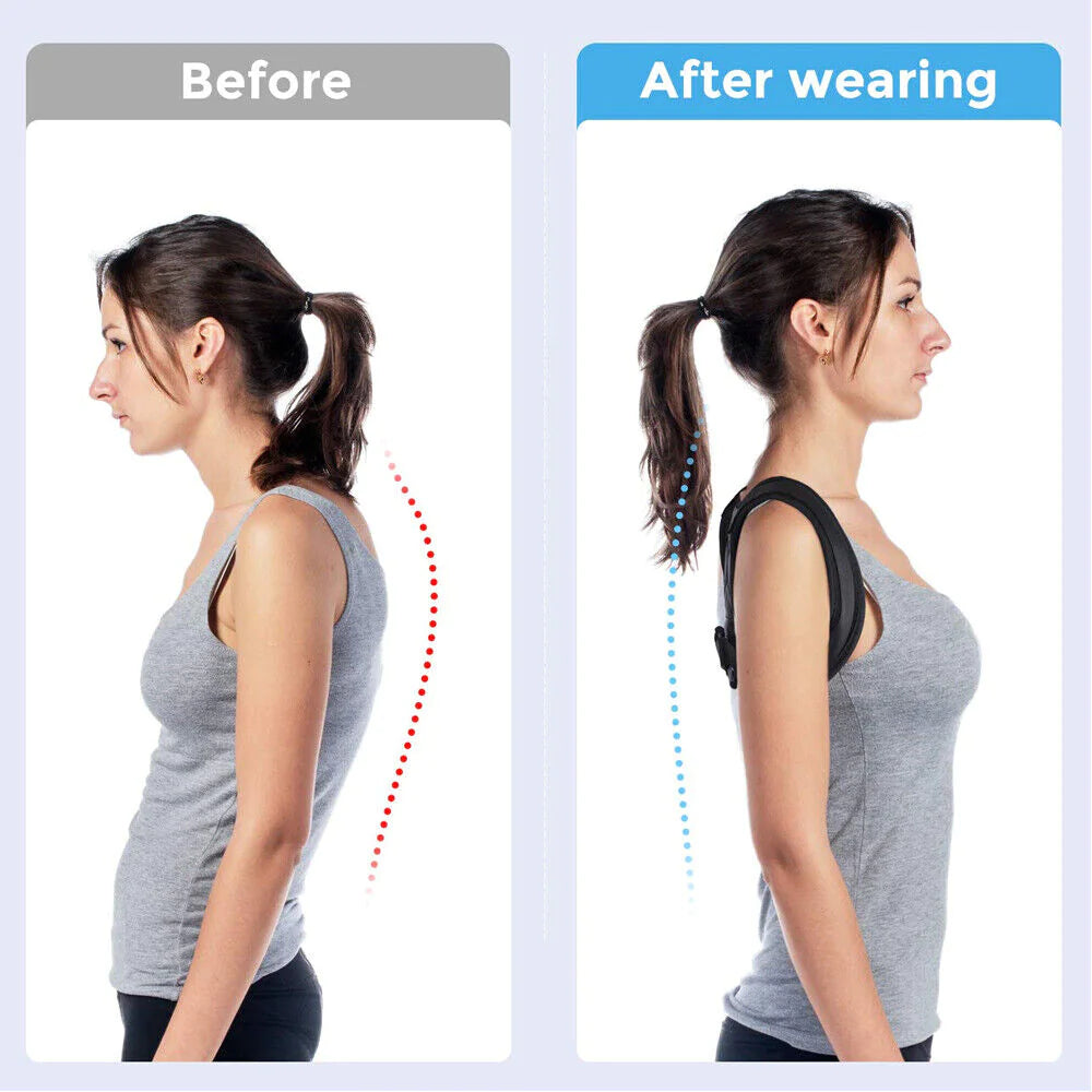 Adjustable Posture Corrector for Back & Shoulders – Clavicle Support Brace for Men & Women