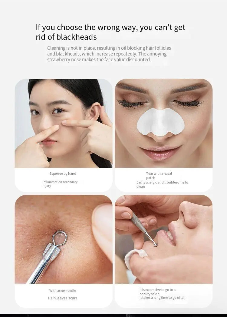 Electric Blackhead Remover